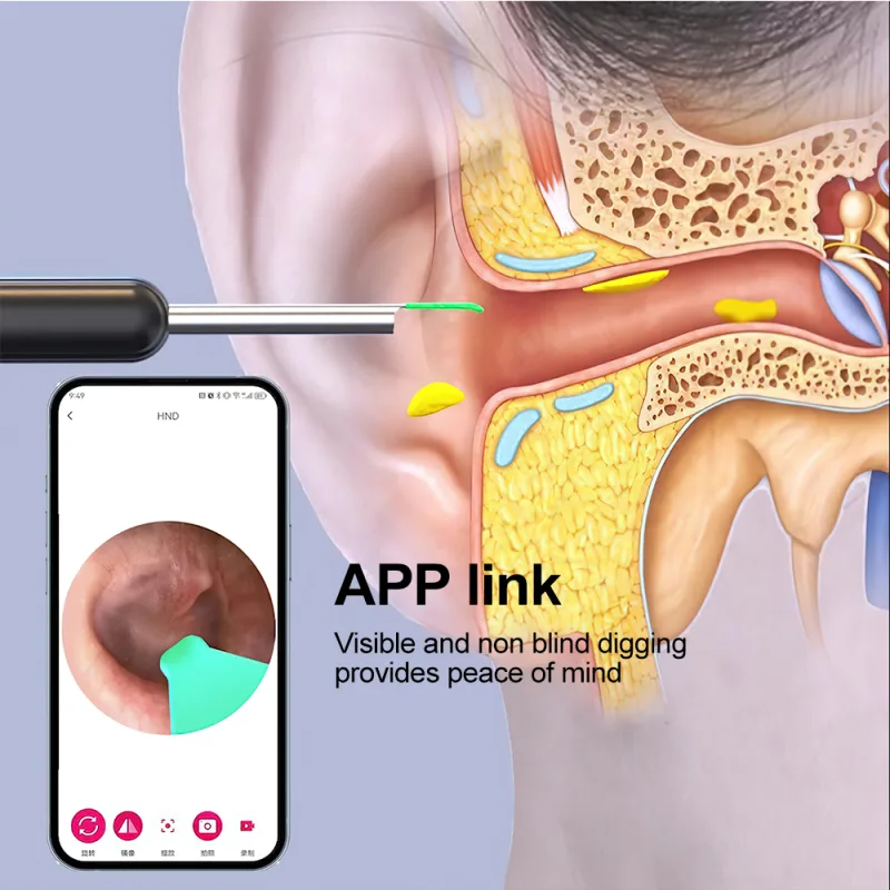 Rechargeable Ear Cleaner with HD Screen Camera image 6