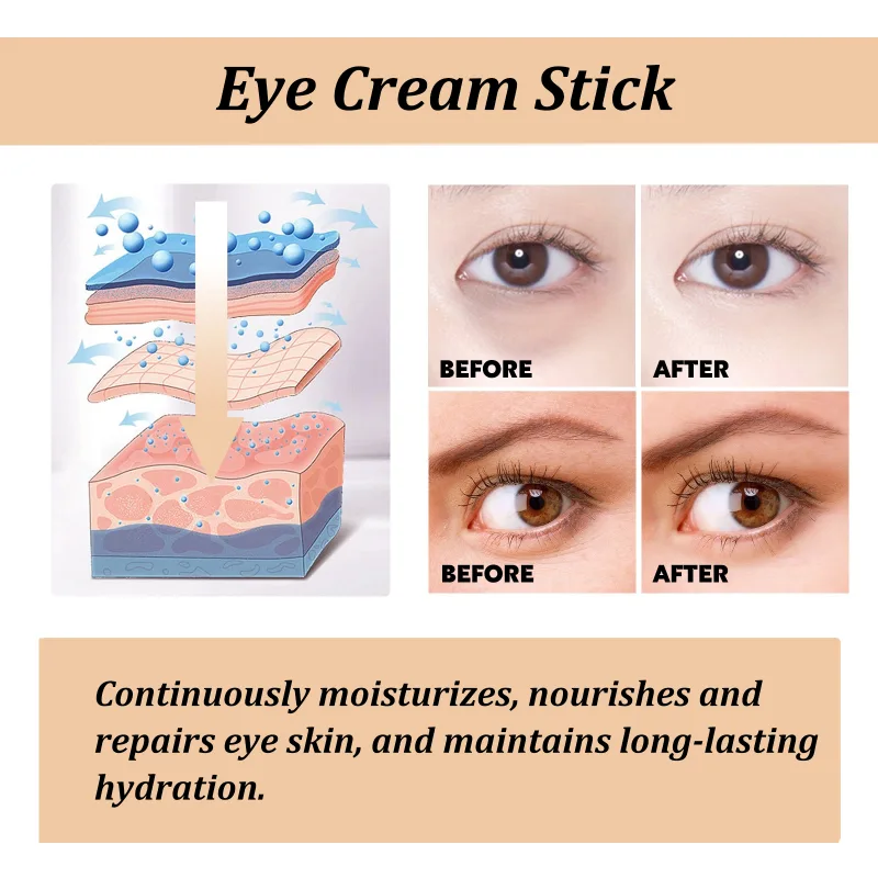 Snail Eye Cream Stick Collagen Fade Fine Lines Wrinkle Lightening Dark Circles Firming Eye Bags Puffiness Moisturizing E image 5