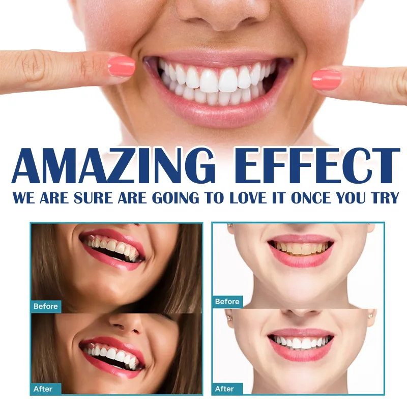 Instant Teeth Whitening Paint 5ml Remove Stains and Yellow Teeth Fast Acting Smile Brightener No Sensitivity Vegan Formu image 3