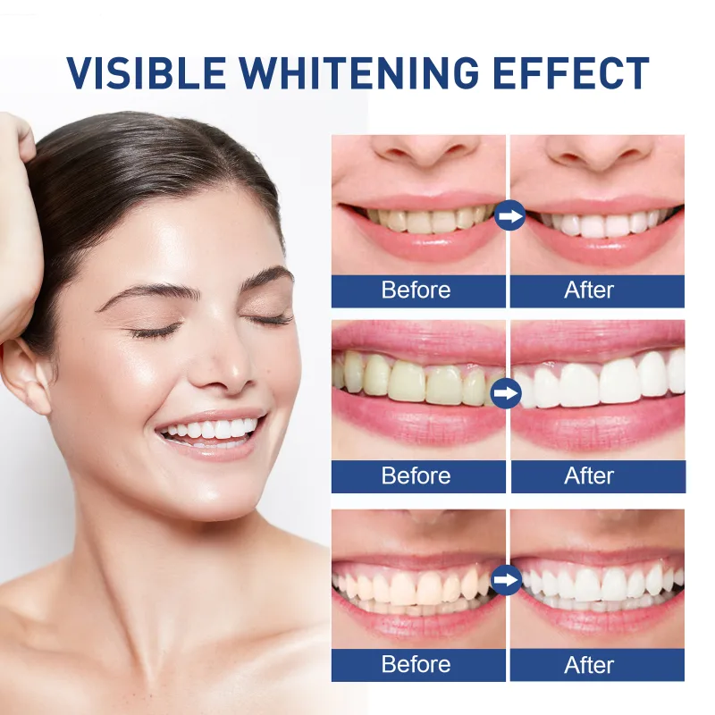 Instant Teeth Whitening Paint 5ml Remove Stains and Yellow Teeth Fast Acting Smile Brightener No Sensitivity Vegan Formu image 5